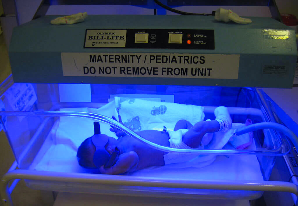Preterm infant in the incubator